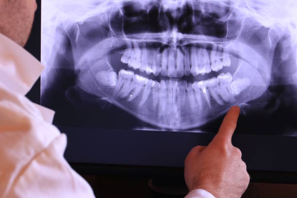Dentist for Dental Trauma in LA