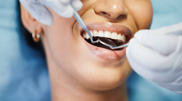 Best Teeth Whitening  in Farmerville, LA